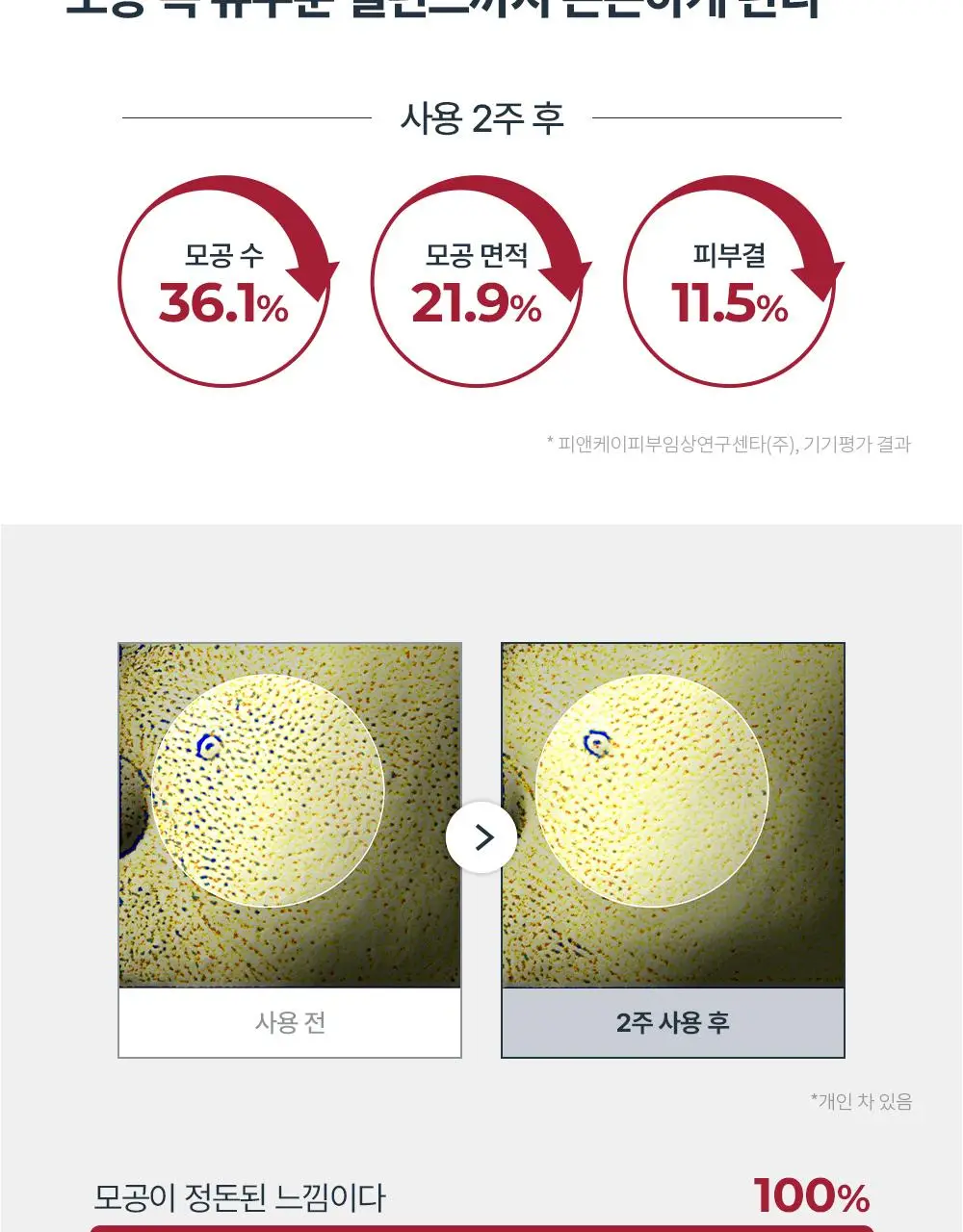 [리뉴얼] 유세린 하이알루론 부스팅 에센스 100ml 상세페이지 16